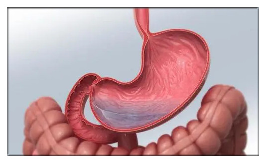使用胃腸機的注意事項